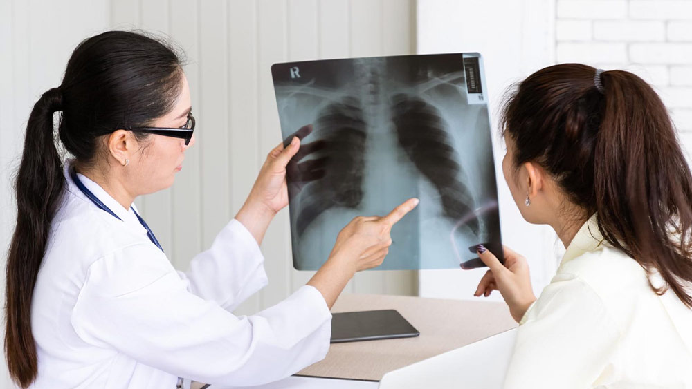 Medic care analizeaza o radiografie pulmonara